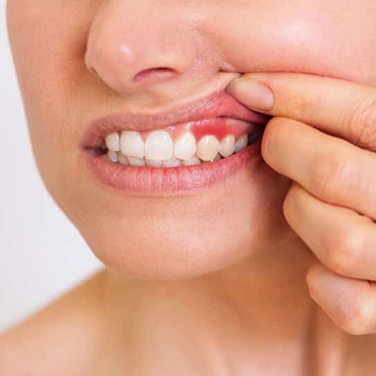 periodontist gum disease