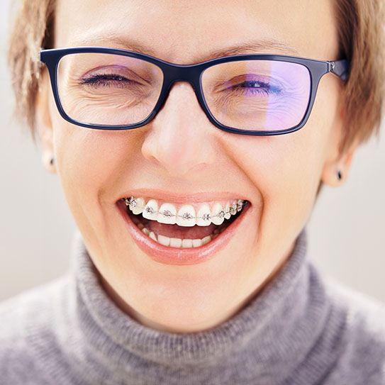 adult braces