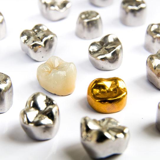 dental crowns